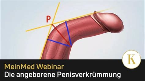 peniskrankheiten|Hautkrankheiten des Penis